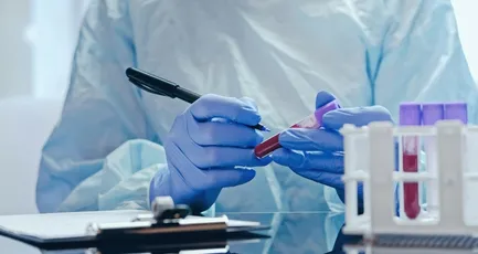 Lab Specimen Collector